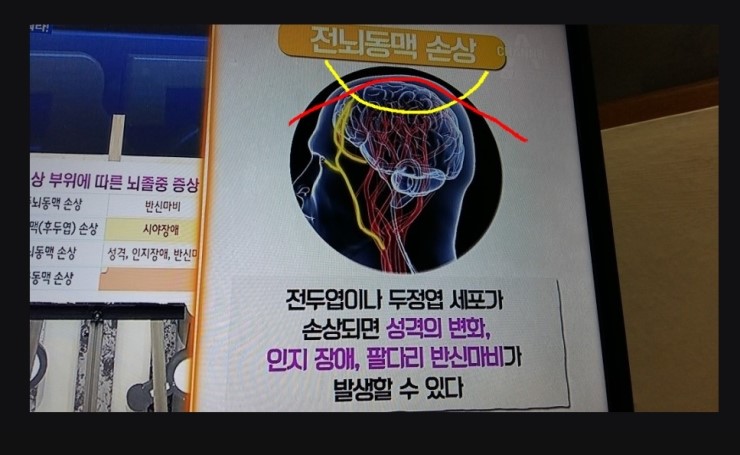  서울서 33명 부상…방음벽 무너지고 교회첨탑 붕괴·정전까지(종합3보) // 다중 메모리 보관 창구는 혼자의 생명이 아니심 <<== 어떤 새끼냐 .. // 내가 사람을 한 번 잡아먹어 보자 / 씹 새끼  <<<== 저 넘 모가지 어서 올리시오 (생각이 못된 경우 얽히게 되는 업보) 