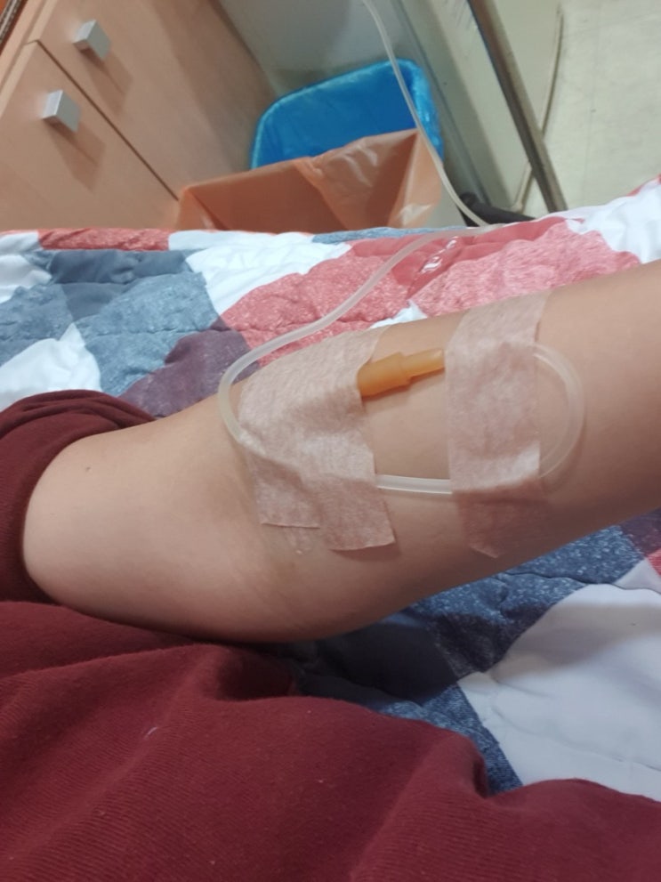  투병일기 ㅠㅠ 전정신경통 이석증