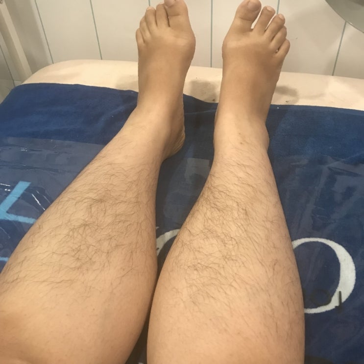  군산왁싱)팔다리왁싱시술 전/후