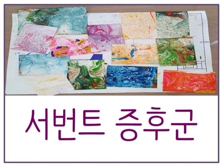 서번트 증후군
