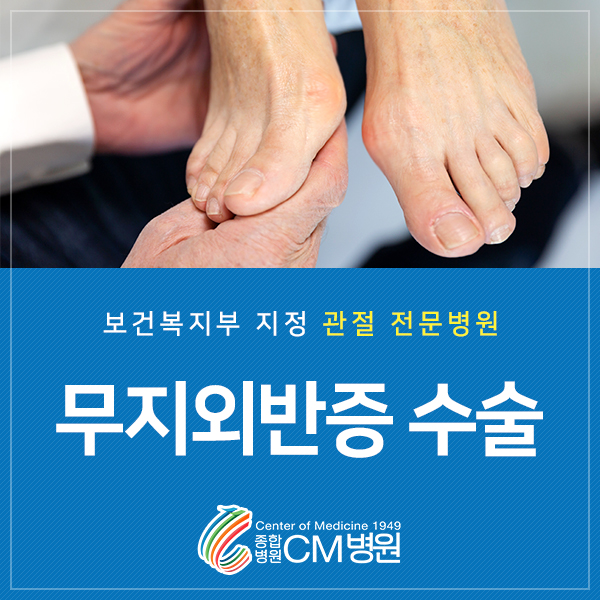  무지외반증 수술 꼭 필요할까?