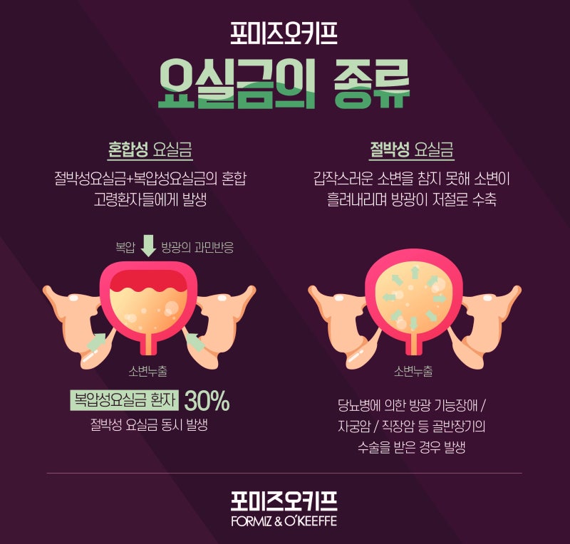 절박성 요실금의 치료는 간단하다 1