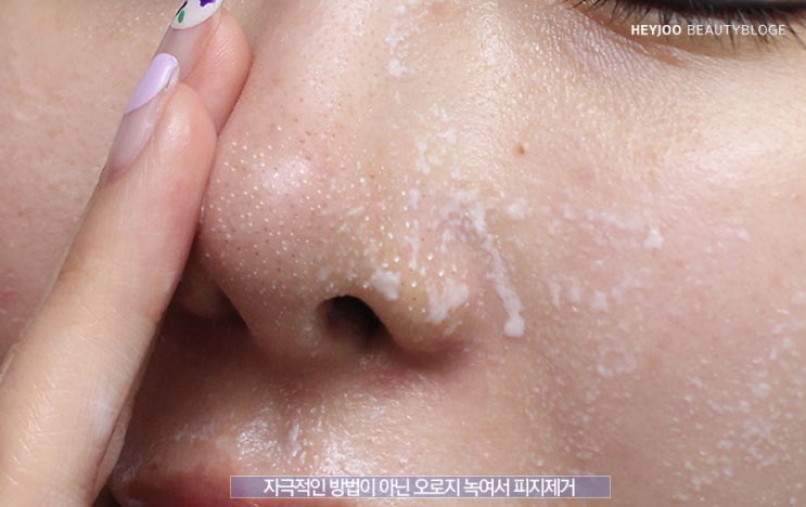  피지 없애는법 못할줄 알았는데 손쉽게 성공