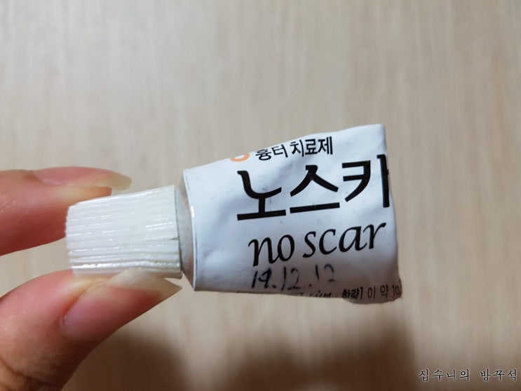  [매일매일 버리기]D+654_노스카나겔