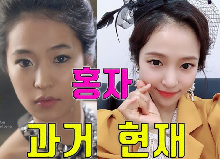  [내일은 미스트롯 근황] 성대결절을 이겨낸 곰탕 목소리의 주인공 l내일은 미스트롯l홍자 말실수l어떻게 살아l