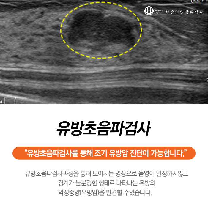 난생처음 유방초음파를 하러 유방외과를 다녀왔다(유방X선촬영, 유방초음파리뷰) 유방초음파비용&실비적용 6