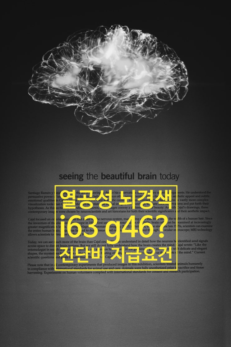  두통(R51), 어지럼증(R42)과 무증상뇌경색(I63), 열공성뇌경색 진단비의 뇌경색 불인정?
