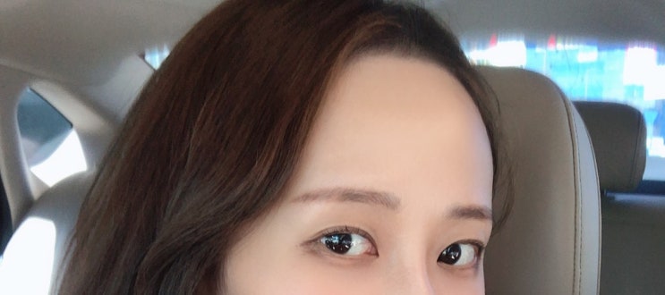 종로 헤어라인왁싱 V왁싱 차이가 눈에보여