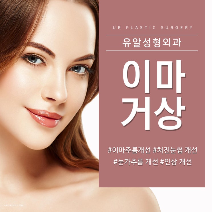  이마거상술후기 잘하는곳이라 달라