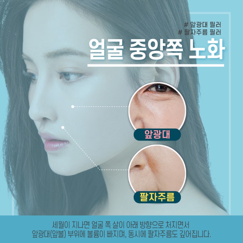 [대구 필러] 앞광대/ 팔자/ 턱필러
