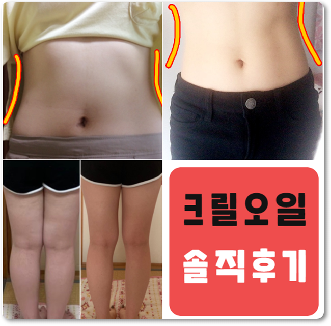  크릴오일 부작용 ? 난이거 효과 후기 복용법 다이어트까지!