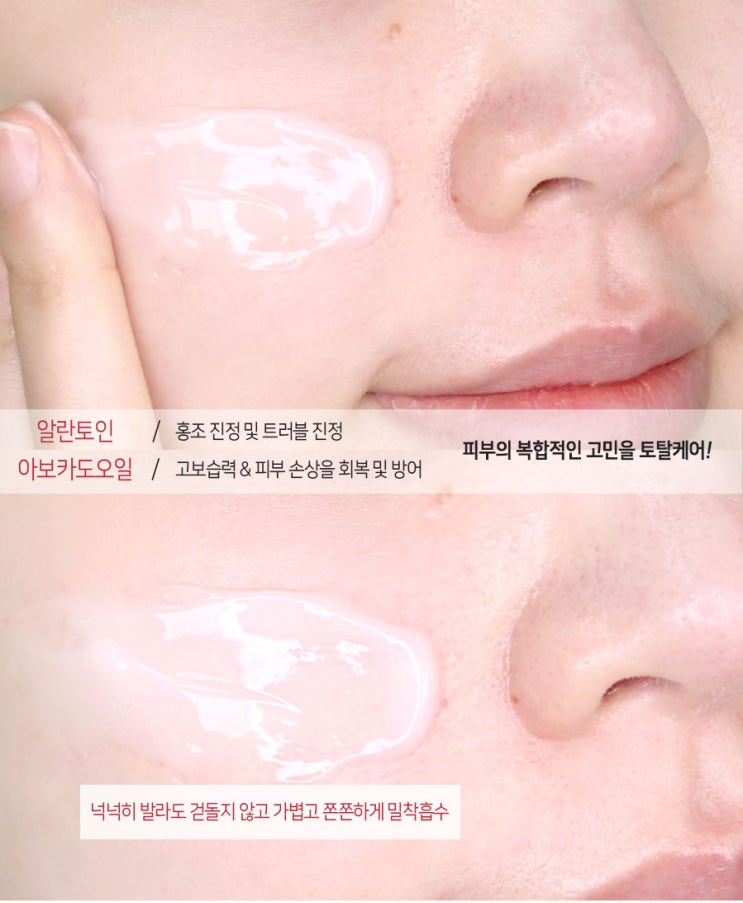  여드름 진정팩 수면 중에도 사용 가능한 잇템 공개