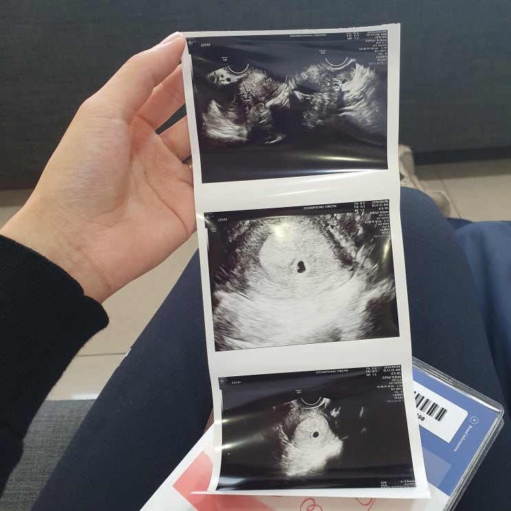 임신4주차, 5주차 증상, 보건소다녀오기, 자몽이와 첫만남