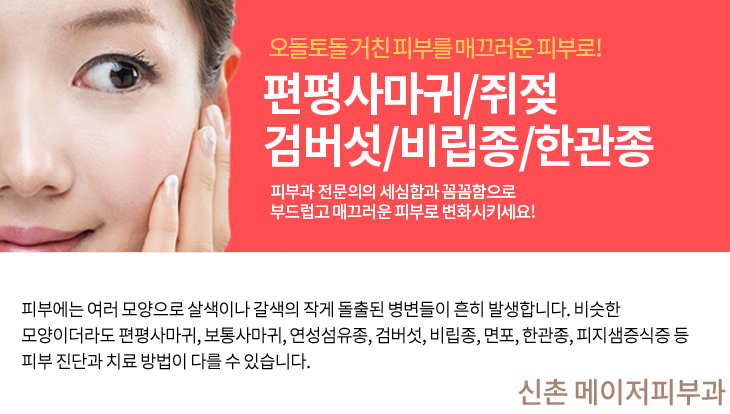 오목천동피부과, 쥐젖과 비립종을 깨끗이 제거하세요! 2
