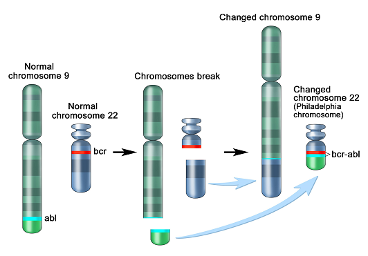  CML(Chronic Myeloid Leukemia, 만성 골수성 백혈병)