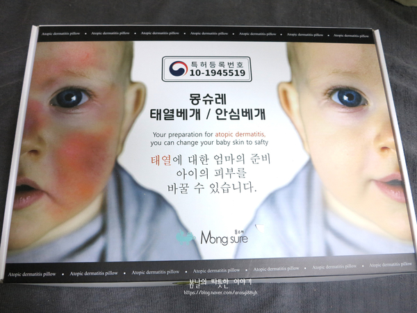  신생아태열 몽슈레 베개로 관리하기!