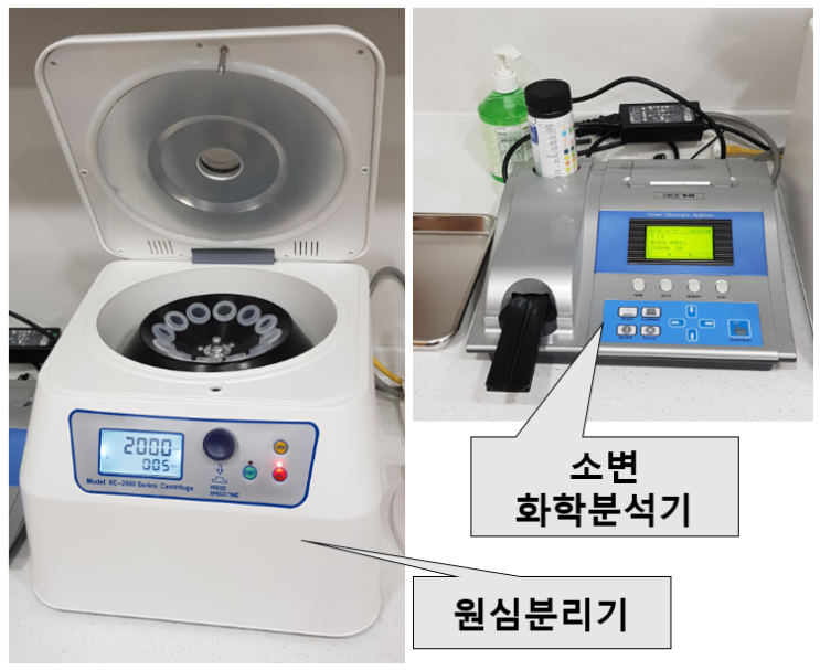  비뇨기과 갈 때는 물을 많이 마시고 소변을 참고 가는 것이 좋은 이유
