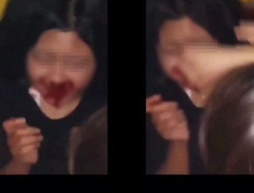 수원 집단폭행, 중학생들이 노래방서 초등생 무차별 폭행