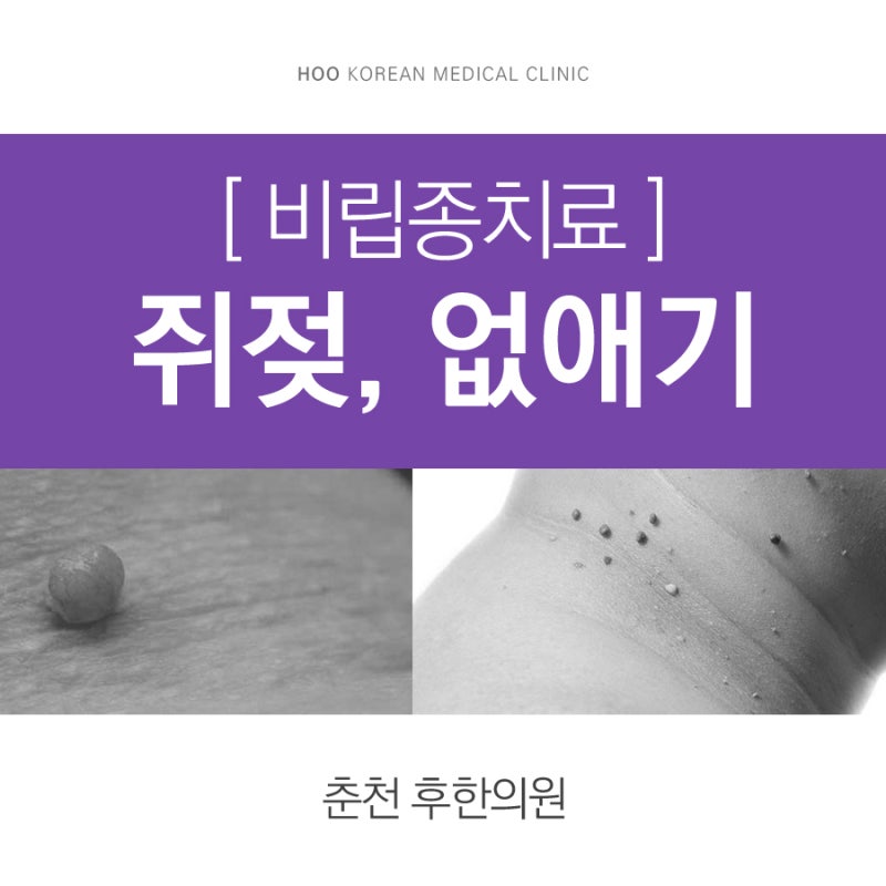 오목천동피부과, 쥐젖과 비립종을 깨끗이 제거하세요! 5