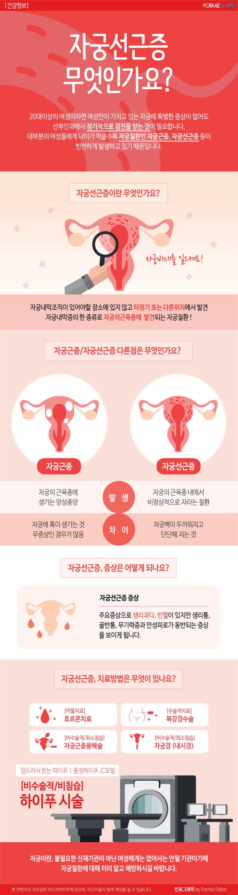 자궁선근증 치료방법 나의 자궁을 지킬 수 있습니다.