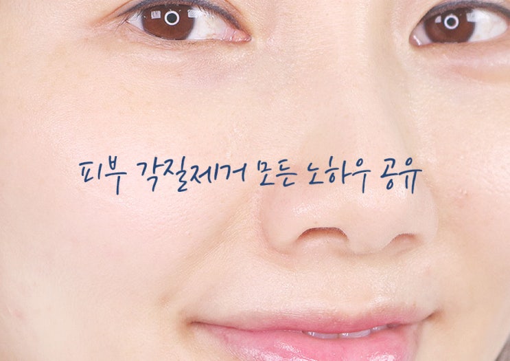  피부 각질제거 프로각질러의 모든 노하우 공유함