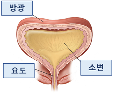  [울산 삼산동 비뇨기과] 방광암의 검사, 연성방광내시경