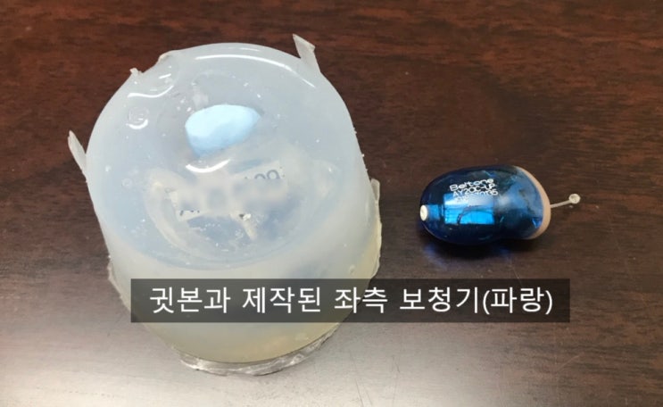  [압구정 강남보청기] 잠실거주 60대 아버님 중이염 귓속형 보청기 착용, 보청기 양이 착용의 효과, 벨톤 보청기 앨리2(AY2 CIC UP) 착용 후기 / 웨이브히어링 강남점