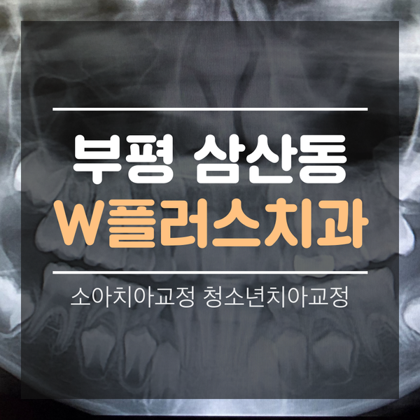  부평 삼산동치과 소아치아교정 청소년치아교정 1차교정