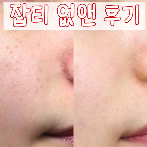  기미 잡티 제거 화이트닝 태닝 효과본 홈케어후기