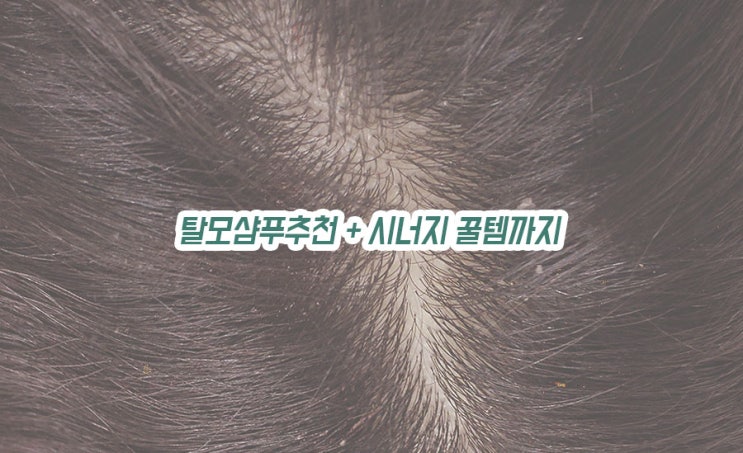  탈모샴푸추천 + 같이 쓰면 좋을 잇템까지 소개