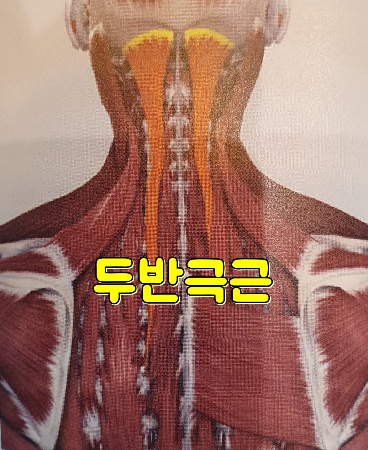  두반극근(Semispinalis capitis SSC), 다열근(경추부) Multifidus MF 허혈성통증