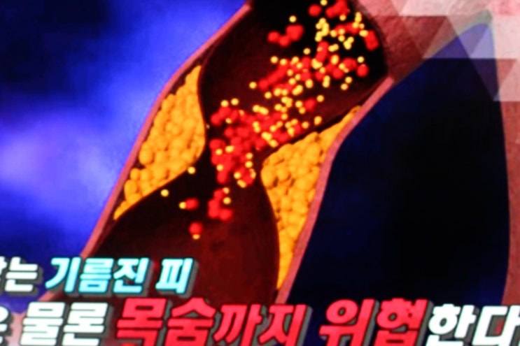  LDL, HDL 총 콜레스테롤 수치의 핵심