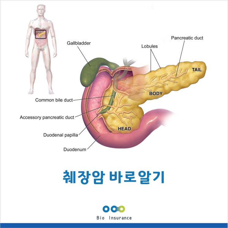 췌장암 바로알기
