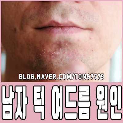  남자 턱 여드름 원인 제대로 알아보자