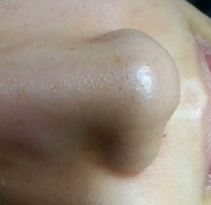  블랙헤드 피부관리의 시작 세안부터 시작해보세요
