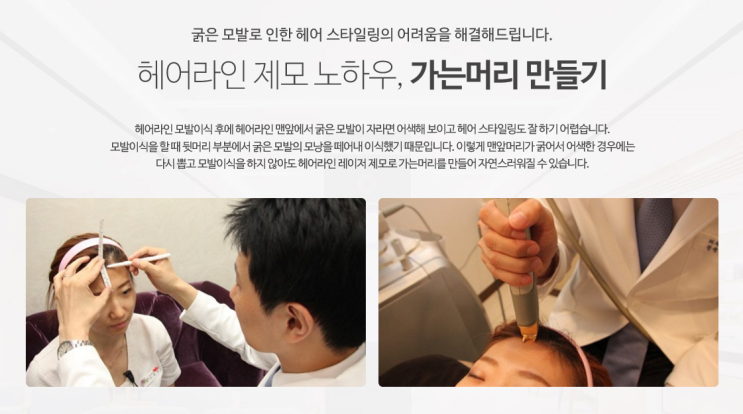  노원헤어라인제모 굵은 머리 가늘게 만들 수 있다? 노원오아로피부과