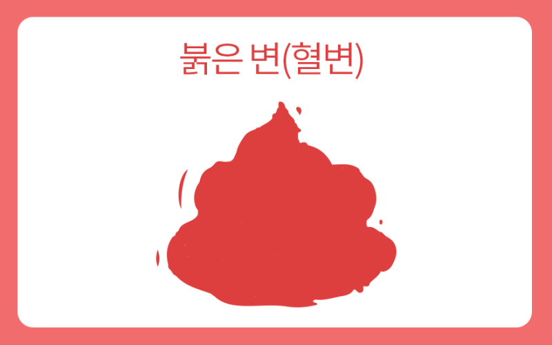 변 색깔과 모양에 따라 알 수 있나요? - 수지항문외과 2