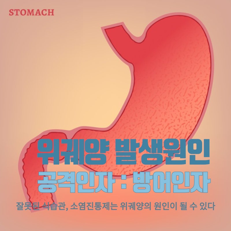 위궤양 증상 치료가 어려운 이유 & 위궤양에 좋은 음식 8