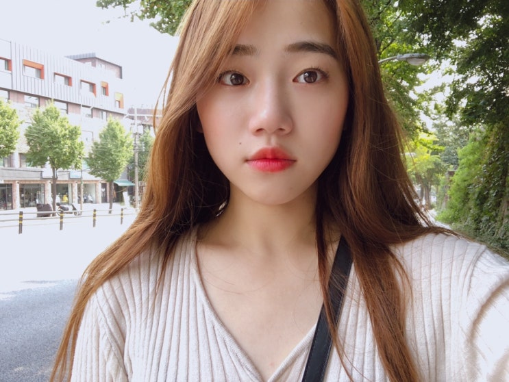  강남피부과유명한곳, 슈링크리프팅 300샷 후기