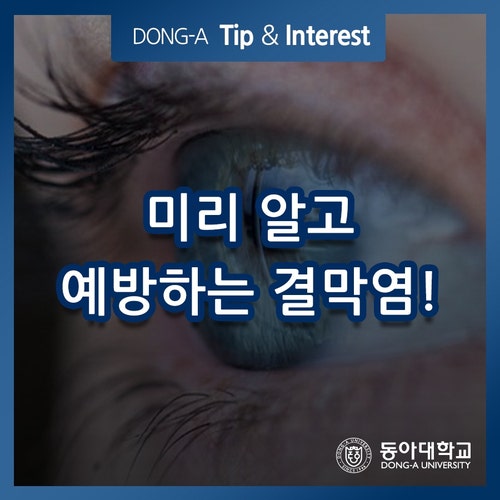 결막염을 미리 알고 대처해 봅시다. 2