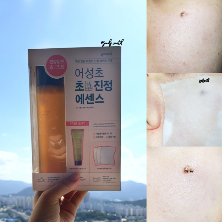  구달 맑은 어성초 진정 에센스 환절기 뒤집어진 피부 진정효과에 딱!
