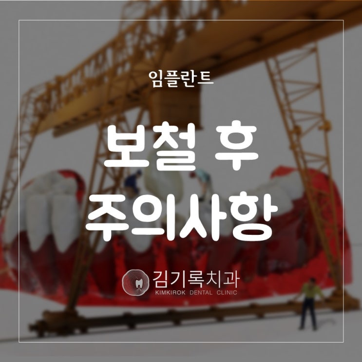 오산임플란트잘하는곳 임플란트 보철 후 주의사항 보철 장착 후 주의사항