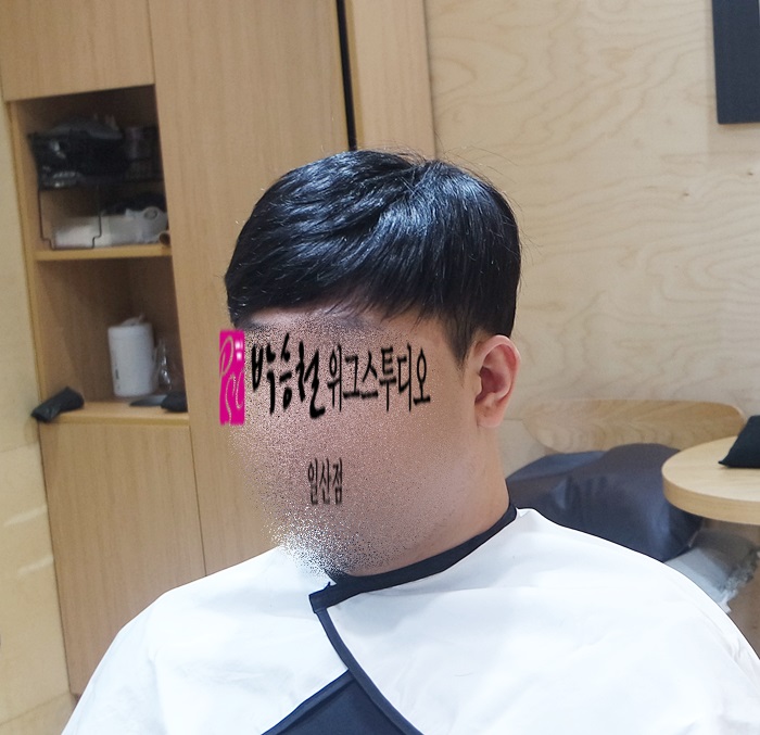  탈모스트레스  한번에해결~~[박승철위그일산점]