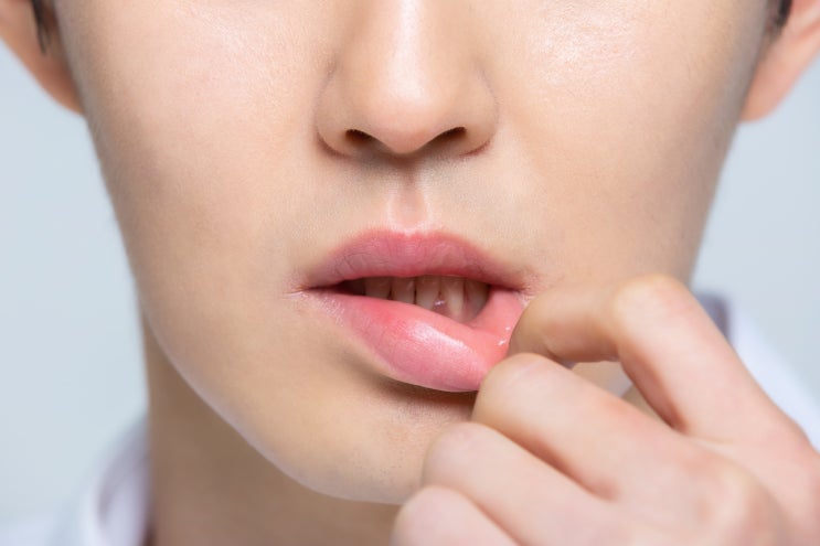  바짝 마르는 입안! ‘구강 건조증’ 주의보!