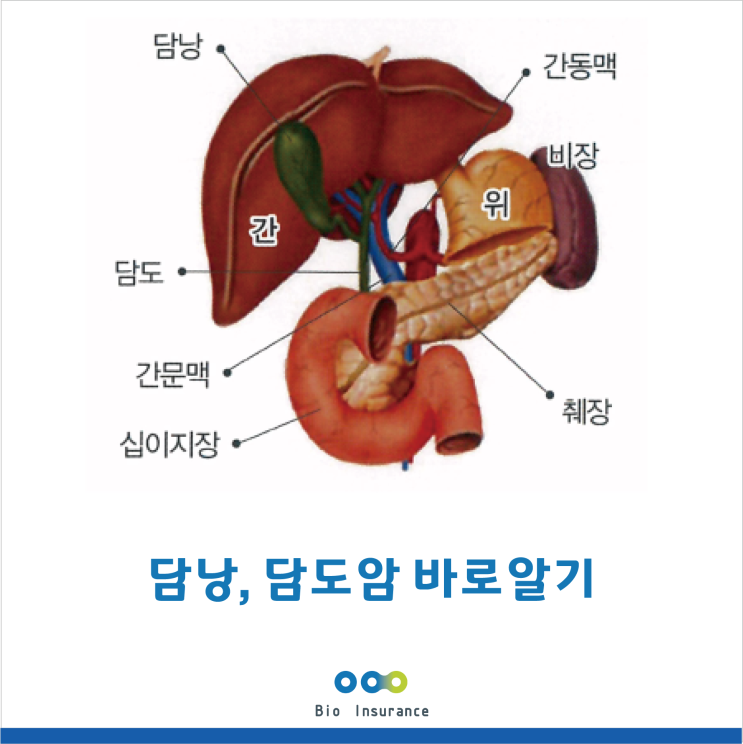  담낭암, 담도암 바로알기