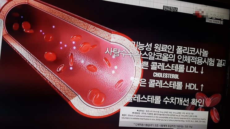  잘못 알려진 HDL 과 LDL 콜레스테롤