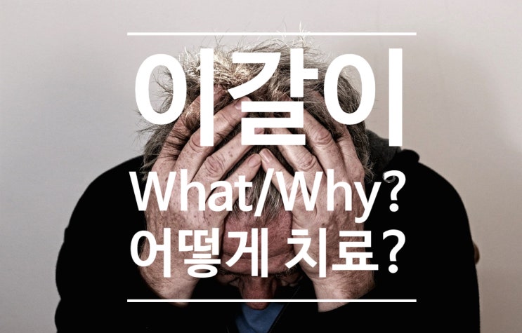이갈이(Bruxism) 어떻게 해야하나요? 교정해야하나? 이갈이(Bruxism) 어떻게 해야하나요? 교정해야하나?