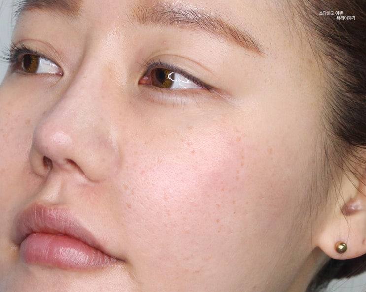 주근깨 생기는 이유 없앨 수 없는 거뭇함 케어법