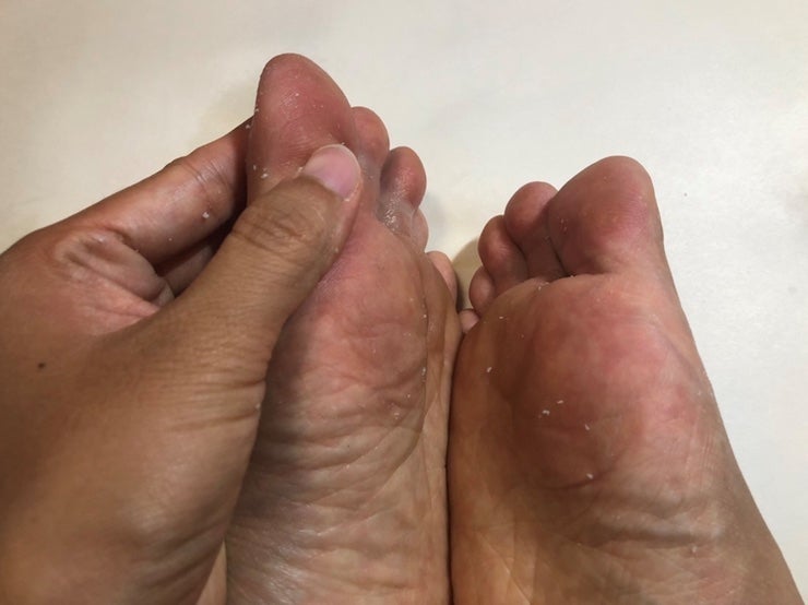 발뒤꿈치각질제거 후기 (약혐주의) 11