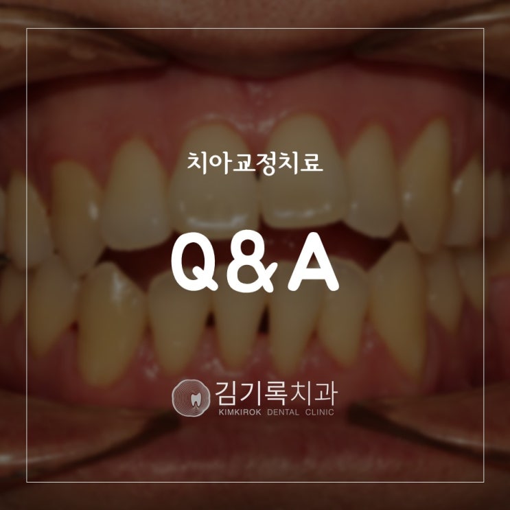 수원교정전문치과 김기록치과 장하나 교정원장이 알려드리는 치아교정치료 Q&A